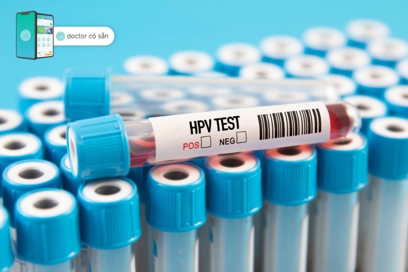 Xét nghiệm HPV tầm soát ung thư cổ tử cung