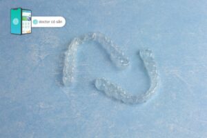 quy trình niềng răng invisalign