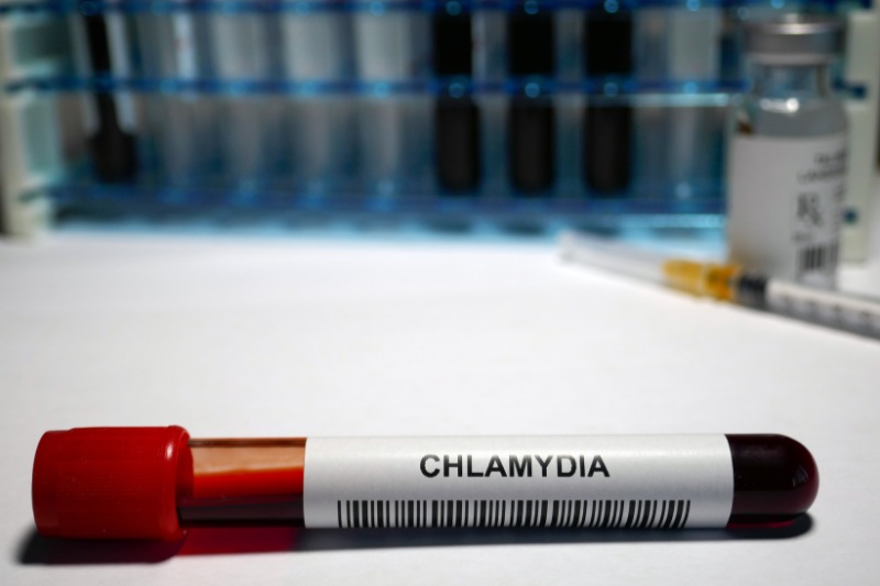 bệnh chlamydia