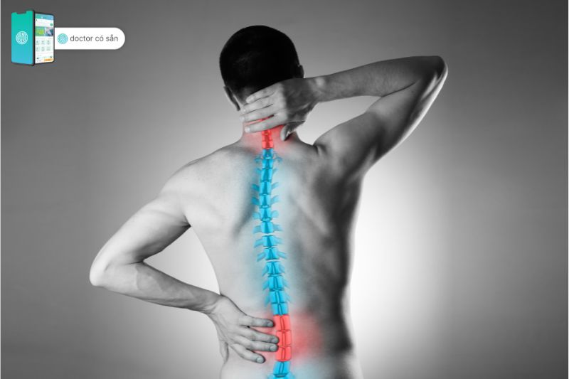 Vẹo cột sống dễ gây ra đau mỏi lưng