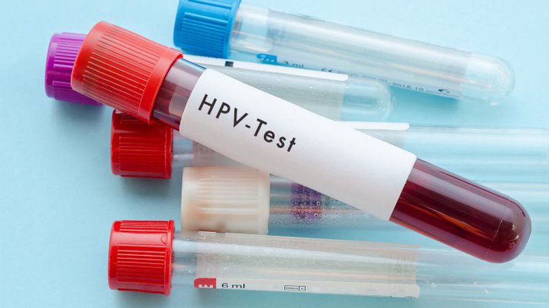 Bài viết giải đáp Xét nghiệm HPV là gì ?