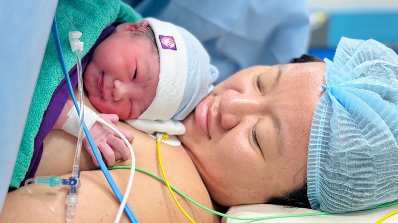 Một ca sinh mổ thông thường kéo dài khoảng 30 đến 60 phút