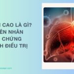 Men gan cao là gì? Nguyên nhân, triệu chứng nhận biết, cách điều trị