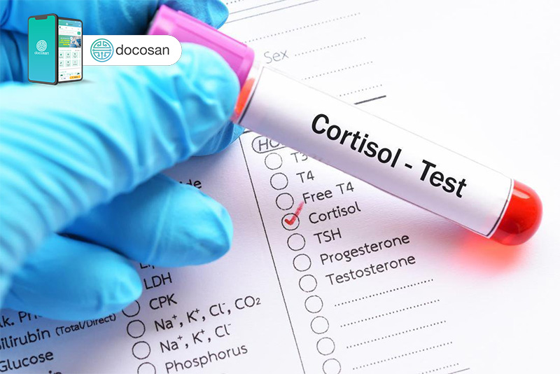 xét nghiệm cortisol