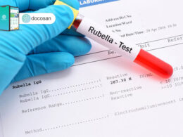 xét nghiệm rubella