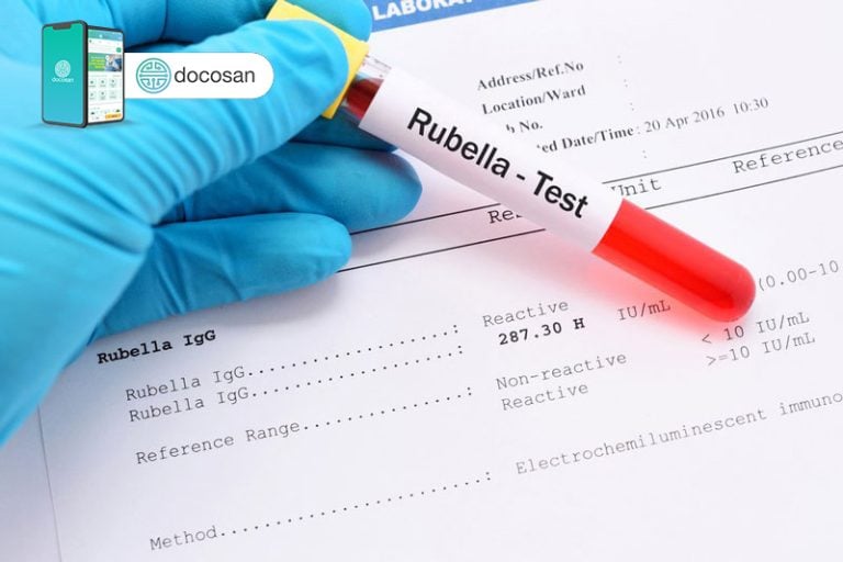xét nghiệm rubella