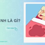 Mộng tinh là gì? Có sao không? Nguyên nhân và cách khắc phục