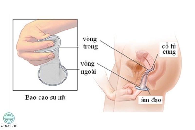 Cách tránh thai sau khi quan hệ không cần thuốc