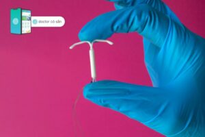 đặt vòng tránh thai giá bao nhiêu