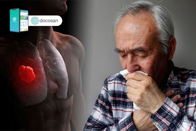 Dấu hiệu ung thư phổi ở nam giới