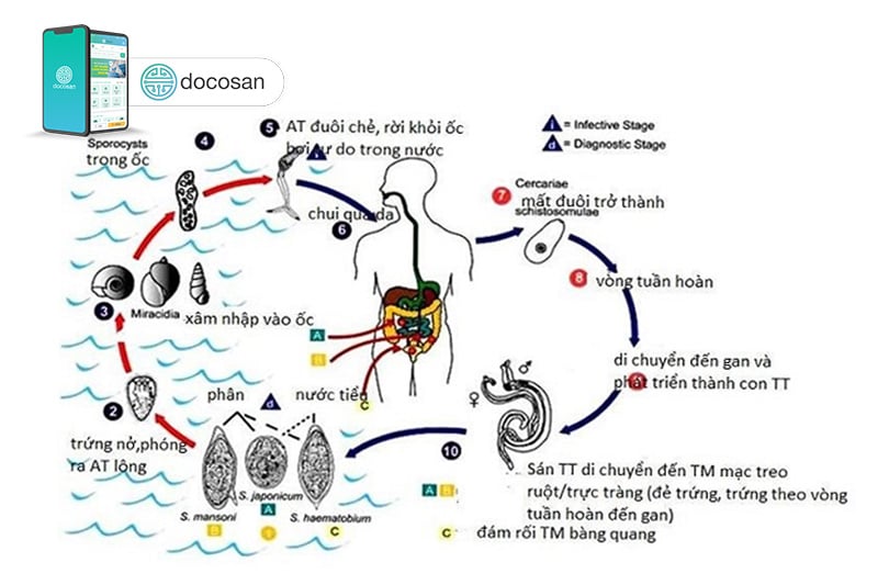 sán lá gan nhỏ