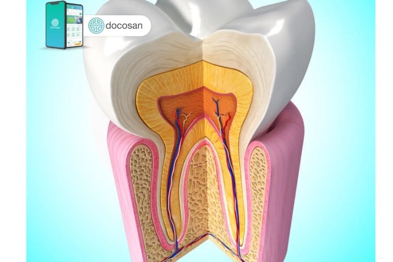 viêm chân răng có mủ
