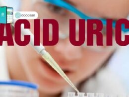 Xét nghiệm acid uric