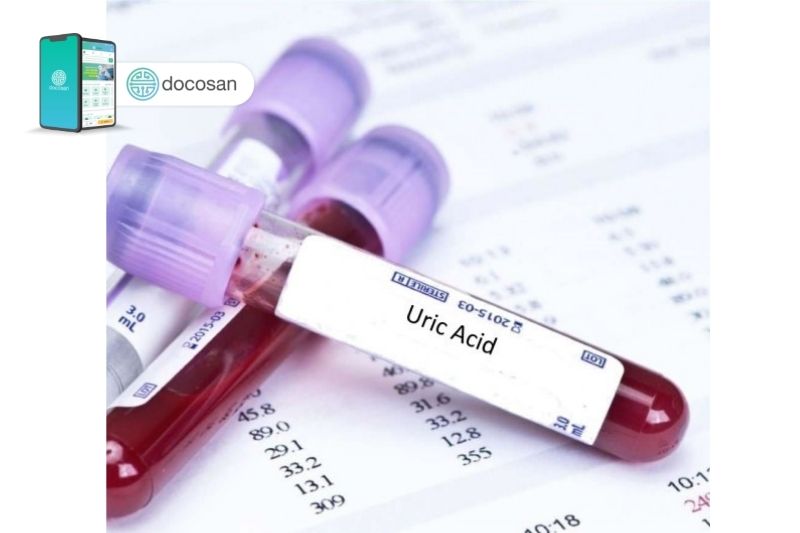 Xét nghiệm acid uric 