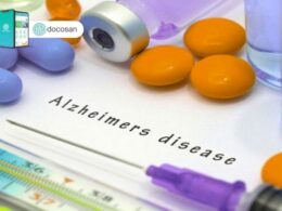 cách chữa bệnh Alzheimer