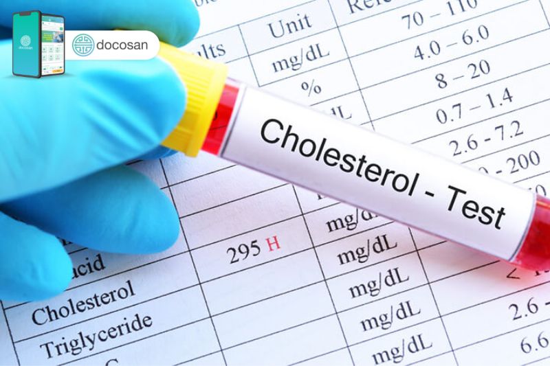 Vai trò của chỉ số cholesterol toàn phần cao mà bạn cần biết Doctor