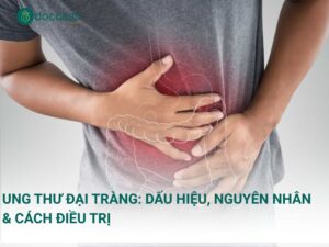 Ung thư đại tràng: Dấu hiệu, nguyên nhân & cách điều trị