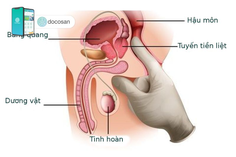 Vị trí tuyến tiền liệt