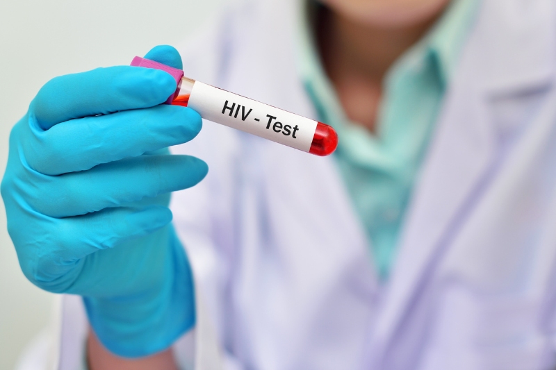 khi nào xét nghiệm hiv