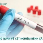 Xét nghiệm bệnh xã hội đóng vai trò hết sức quan trọng, đặc biệt là các đối tượng có nguy cơ cao