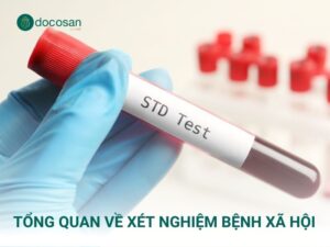 Xét nghiệm bệnh xã hội đóng vai trò hết sức quan trọng, đặc biệt là các đối tượng có nguy cơ cao