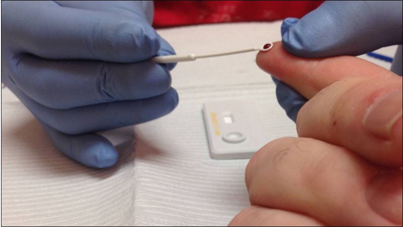 Test HIV bằng máu là phương pháp xét nghiệm truyền thống