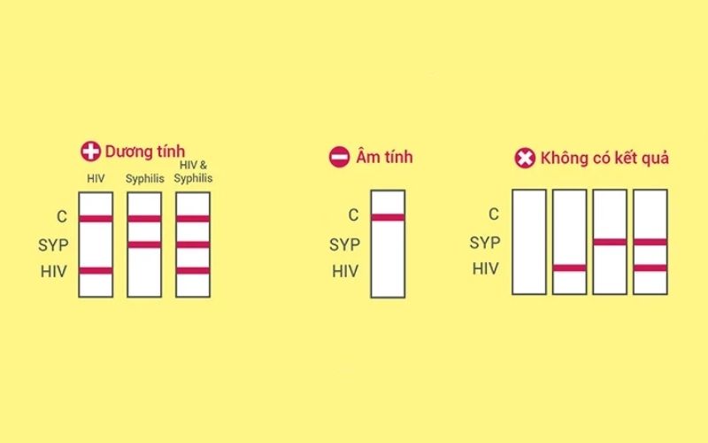 Mỗi bộ sản phẩm test nhanh HIV sẽ có cách đọc khác nhau, bạn cần tham khảo hướng dẫn từ nhà sản xuất
