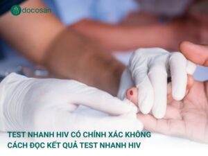 Test nhanh HIV có chính xác không? Cách test nhanh HIV