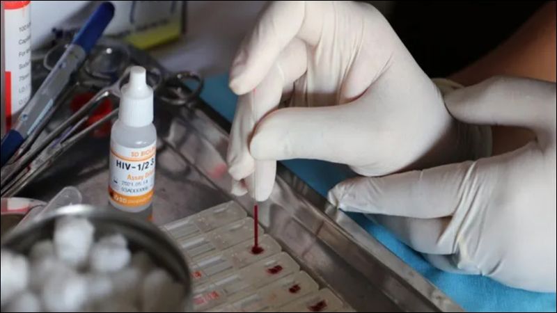Xét nghiệm HIV tại cơ sở y tế được phần đông bệnh nhân lựa chọn