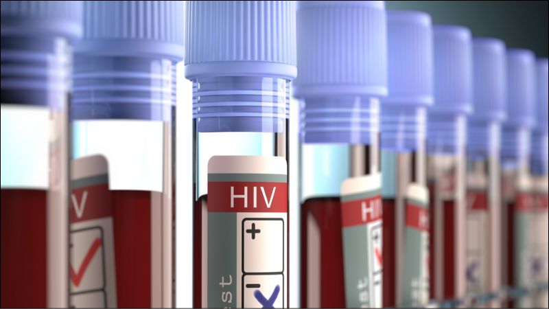 Người bệnh có thể xét nghiệm HIV trực tiếp hoặc gián tiếp