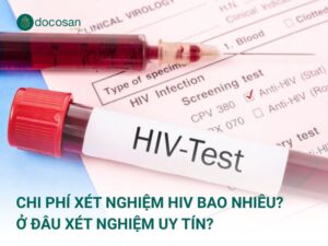 Chi phí xét nghiệm HIV bao nhiêu? Ở đâu xét nghiệm uy tín?