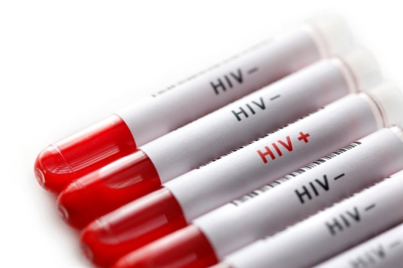 hiv dương tính giả