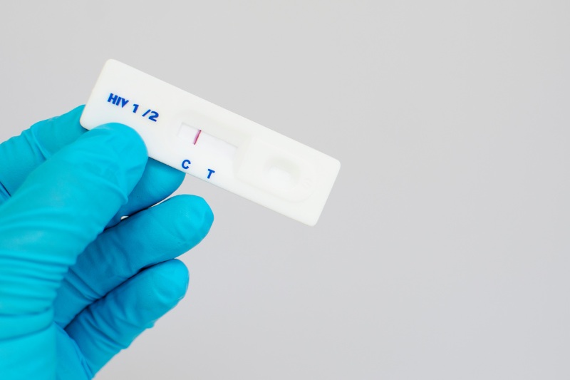 rapid HIV test