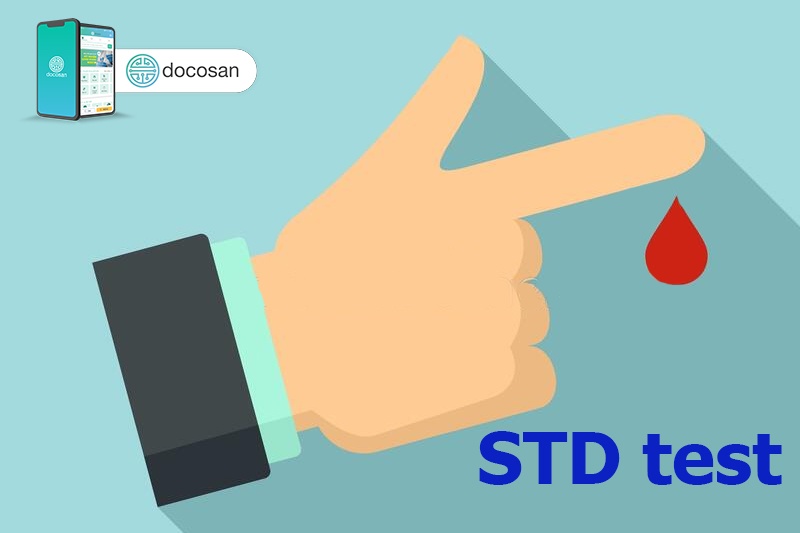 What does the STDS test include? Where is the test? Doctor có sẵn