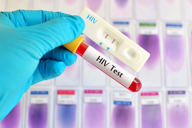 xét nghiệm hiv