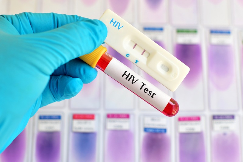 benefits of HIV home test kit