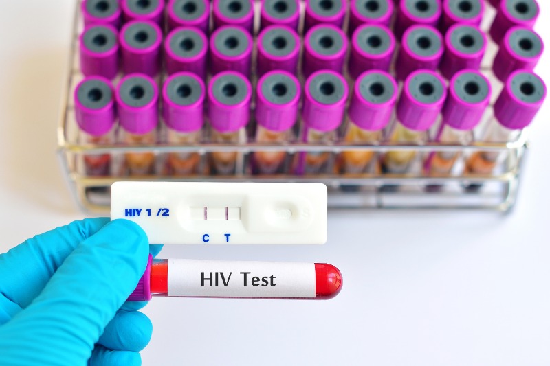 hiv test cost