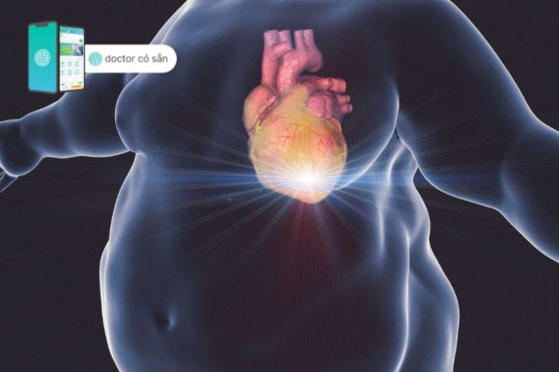 Béo phì có thể dẫn đến các bệnh về tim mạch và đột quỵ