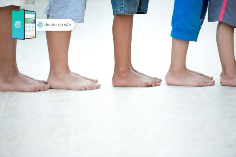 Trẻ còi xương có nguy cơ bị chân vòng kiềng