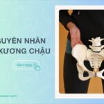 Đau xương chậu: Top 20 Nguyên nhân, triệu chứng, điều trị và lưu ý