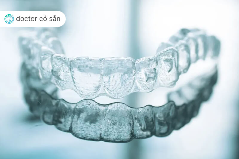The Ultimate Guide to Invisalign in Vietnam | Doctor có sẵn