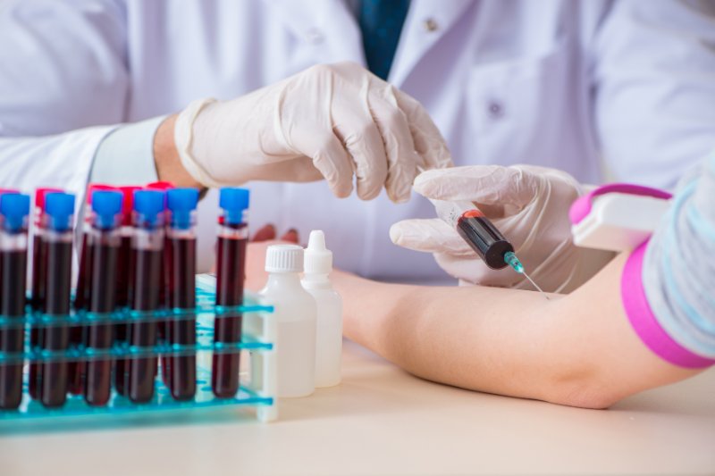 Xét nghiệm công thức máu là một trong những xét nghiệm thường quy trong chẩn đoán bệnh máu trắng