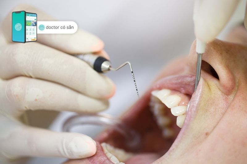 Có nhiều loại phẫu thuật nha chu khác nhau tùy thuộc tình trạng răng miệng