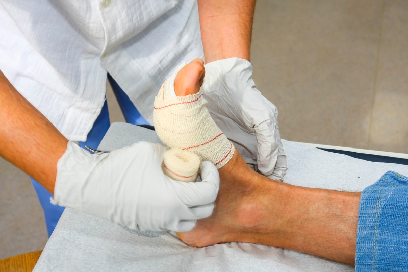 Thay băng cắt chỉ là phương pháp điều trị và xử lý vết thương phòng tránh tình trạng nhiễm trùng
