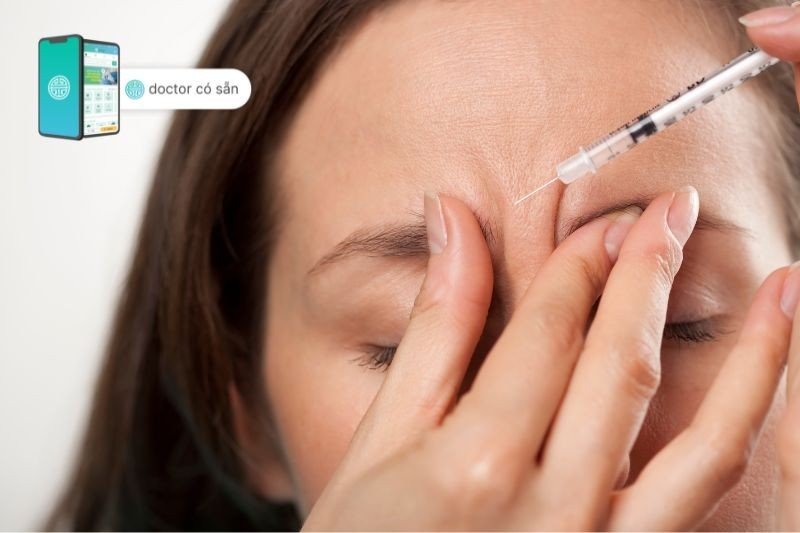 Vị trí tiêm botox xóa nhăn mắt được xác định bằng cách yêu cầu bệnh nhân chủ động cau mày và tiêm thuốc vào các cơ đã co lại