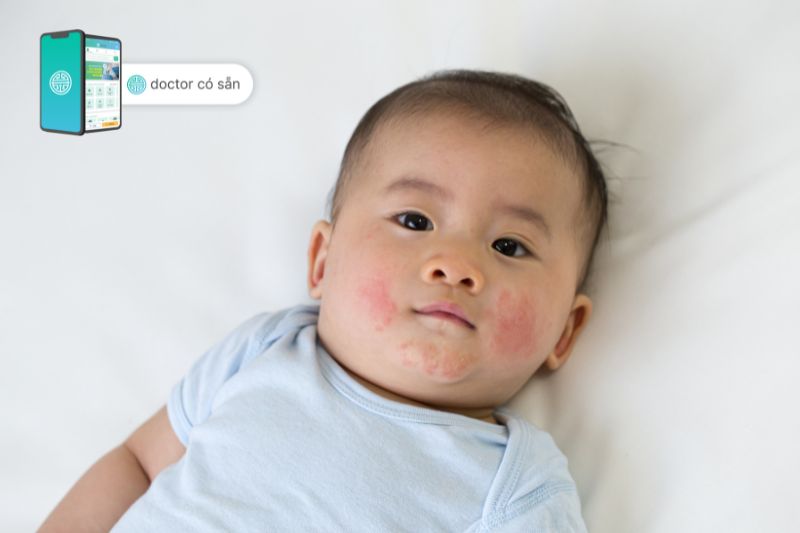 Eczema can occur at any age, but it is most commonly found in infants and children
