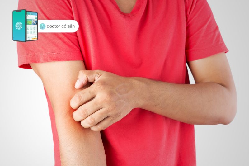 Eczema often targets specific areas: face, hands, feet, elbows, and knees