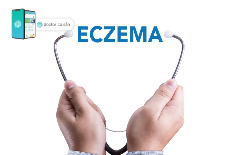 A physical exam evaluates eczema's rash severity and distribution