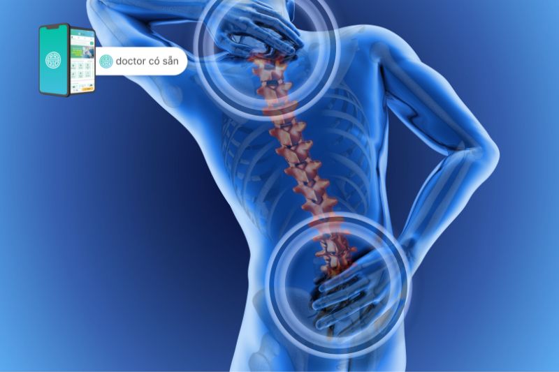 Các vị trí đau lưng có thể biểu hiện ở dạng cấp tính hay mạn tính