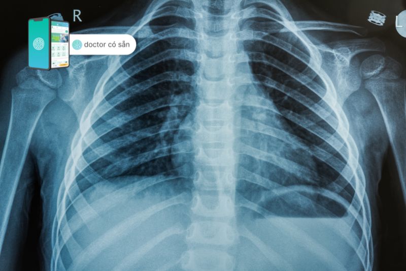 Chẩn đoán các vị trí đau lưng bằng hình ảnh X quang